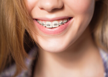burwood cost of braces expect to pay